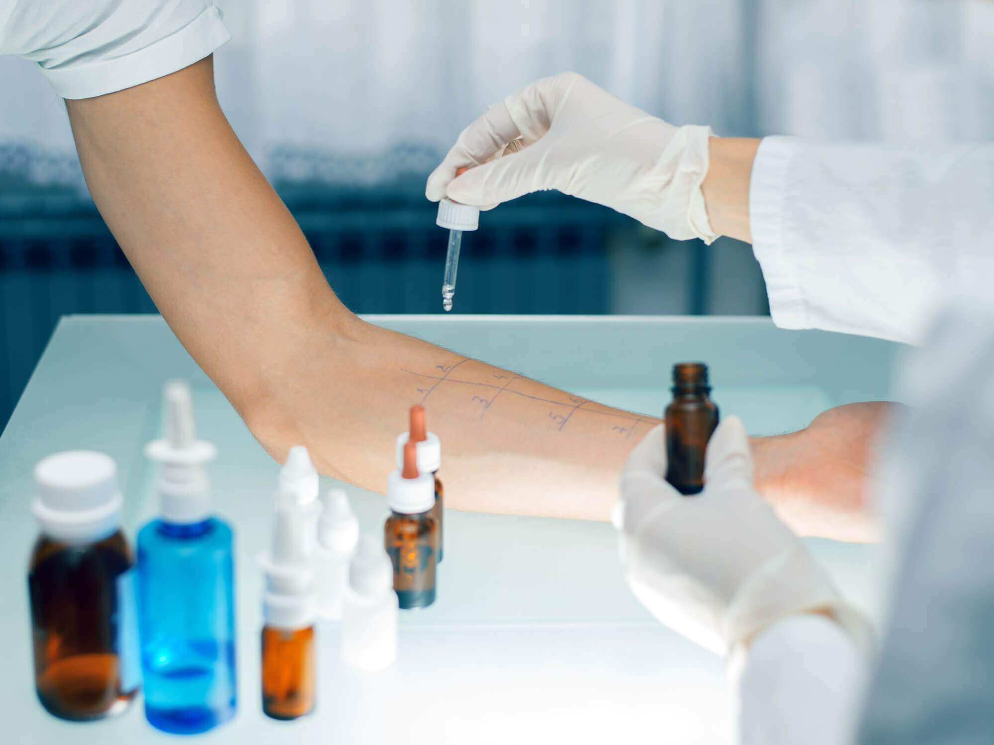 Coceira, vermelhidão, inchaço? Veja 5 tipos de alergias na pele e como tratá-las